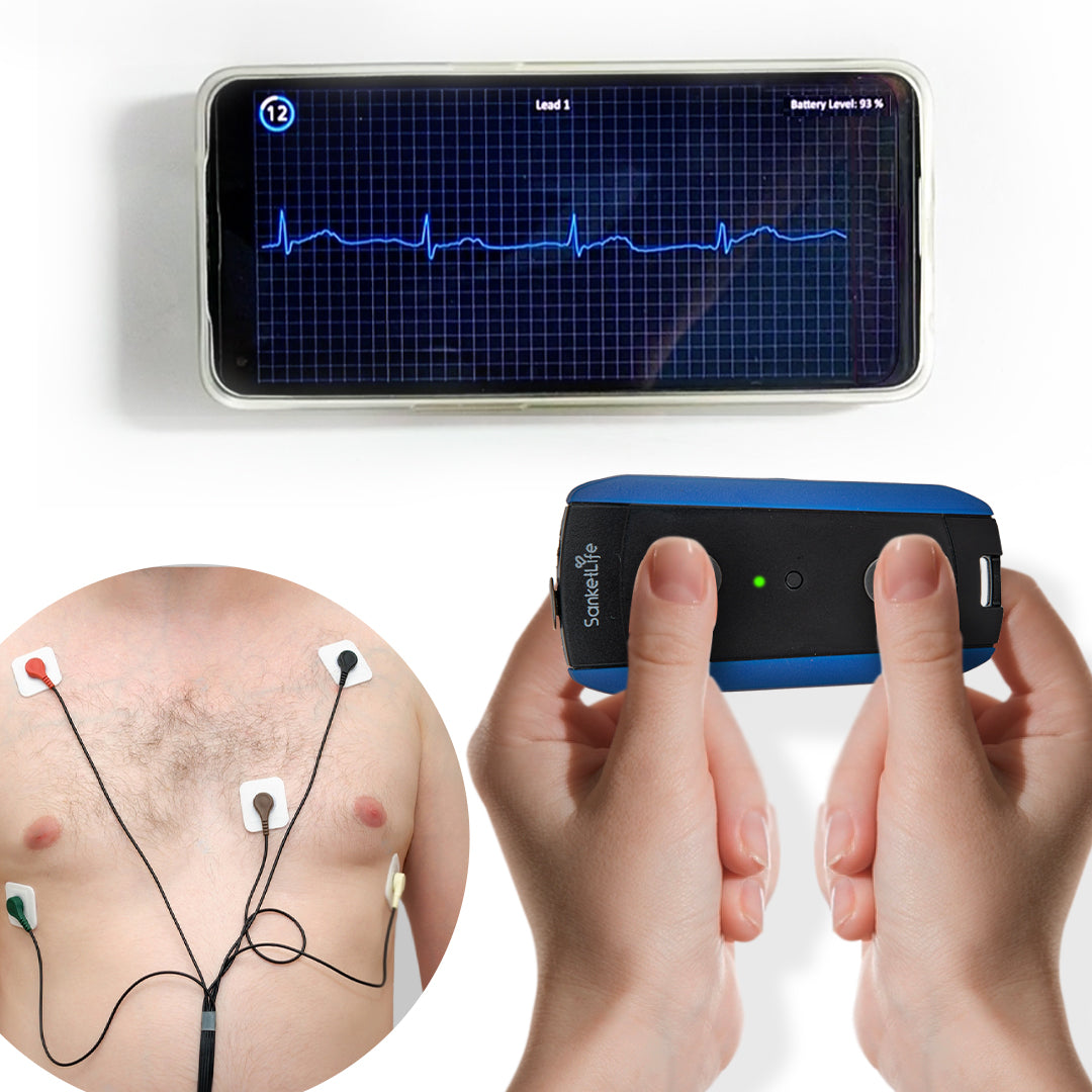The Best Portable EKG for Healthcare Providers in 2022 